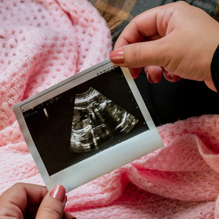 Ultraschall.jpg Ultraschallbild eines Babys, gehalten vor einer rosa Decke.